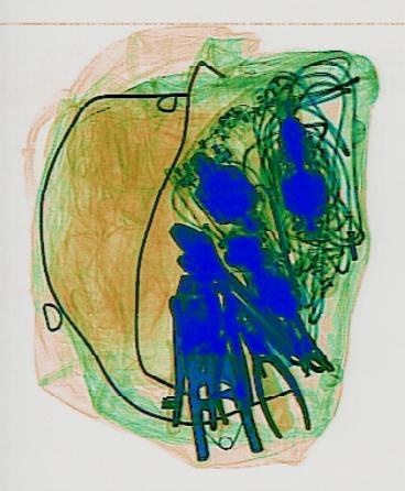 Detection preview by DN_Medium_300_yolov8m_20t7_new