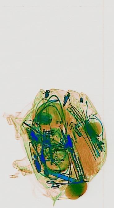 Detection preview by DN_Medium_300_yolov8m_20t7_new