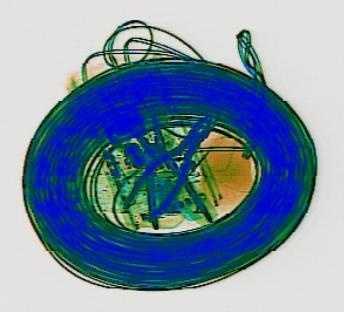 Detection preview by DN_Medium_300_yolov8m_20t7_new