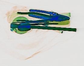 Detection preview by DN_Medium_300_yolov8m_20t7_new