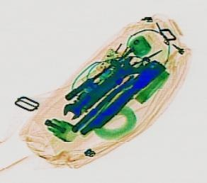 Detection preview by DN_Medium_300_yolov8m_20t7_new