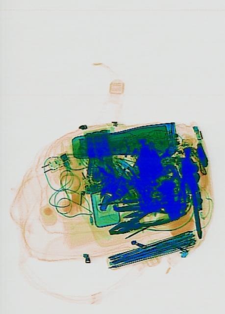 Detection preview by DN_Medium_300_yolov8m_20t7_new