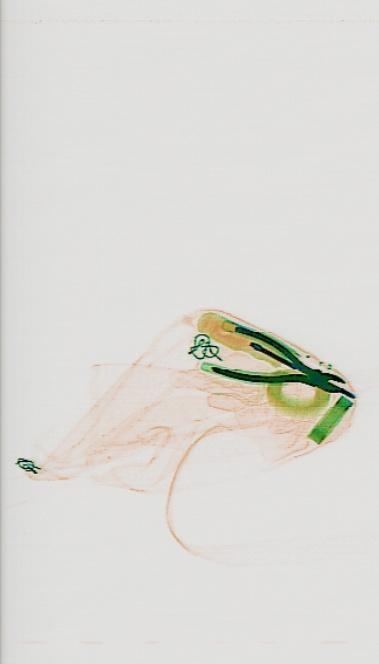 Detection preview by DN_Medium_300_yolov8m_20t7_new