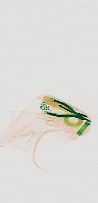 Detection preview by DN_Medium_300_yolov8m_20t7_new