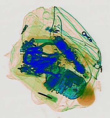 Detection preview by DN_Medium_300_yolov8m_20t7_new