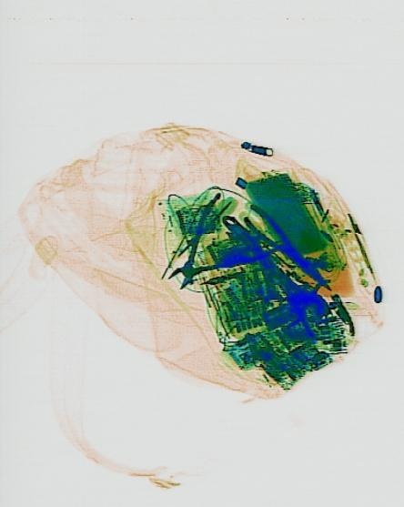 Detection preview by DN_Medium_300_yolov8m_20t7_new